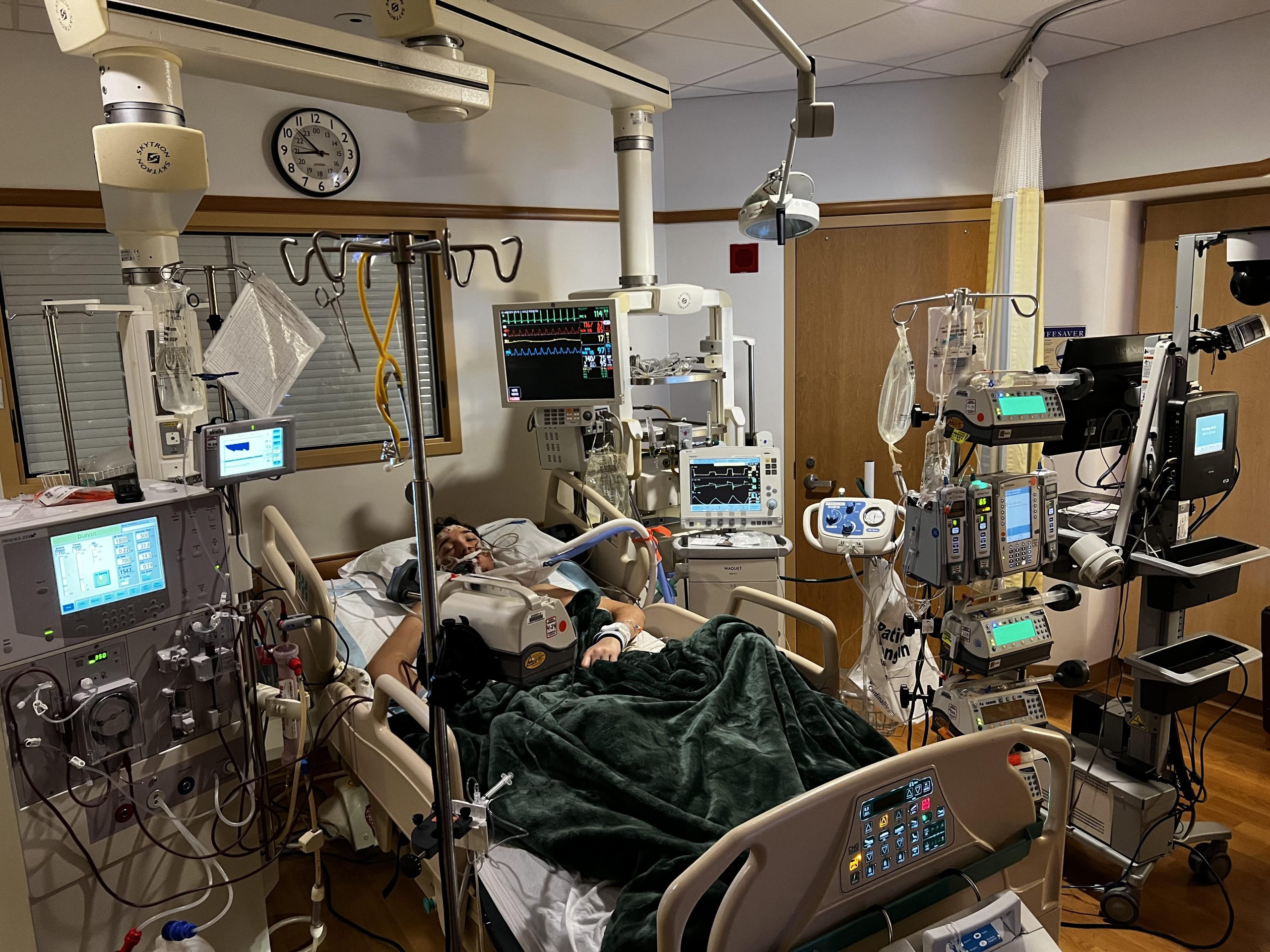 dev_ICU2
